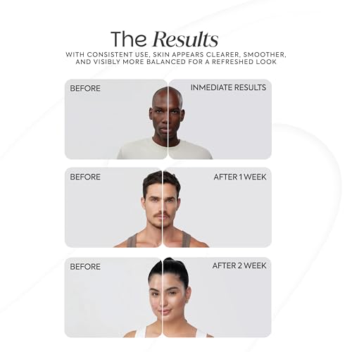 korean Skin Care Kit Zen Balance, 6 Step Routine for Sensitive and Oily Skin with 4 Hydrogel Masks, Complete kit skincare AM/PM Routine with Targeted Spot Treatment - Image 6