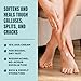 AmLactin Foot Repair Cream - 3 oz Cream for Dry Cracked Heels with 15% Lactic Acid - Exfoliator and Moisturizer for Dry Skin (Packaging May Vary)