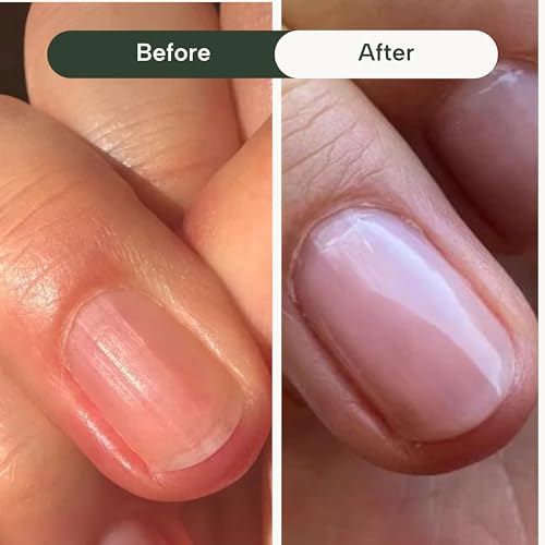 beautygarde smooth rocket ridge filler - 05 oz nail hardener and strengthening growth treatment vegan amp free of harmful chemical builder gel for nails resurfaces nail ridges promotes nail growth