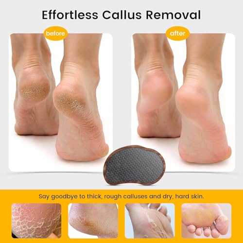 Image of BEZOX Glass Foot File - Nano-Glass Pumice Stone Foot Scrubber, Heel File Callus Remover for Silky Smooth Feet, Portable Pedicure Tool for Summer & Vacation - Walnut Wood Handled