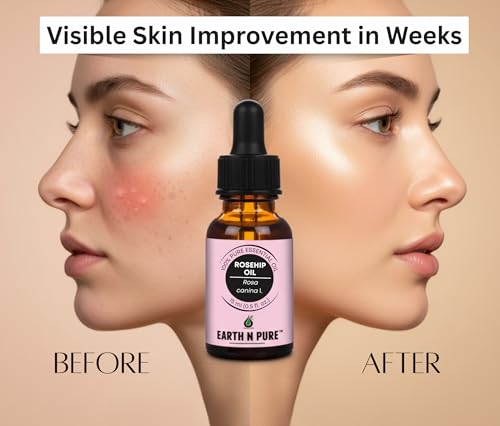 Image of Earth N Pure Rosehip Oil for Face & Glowing Skin - 100% Pure Natural Rosehip Seed Oil for Even Skin Tone, Hydration & Radiance - Cold Pressed Face Oil - 30ml