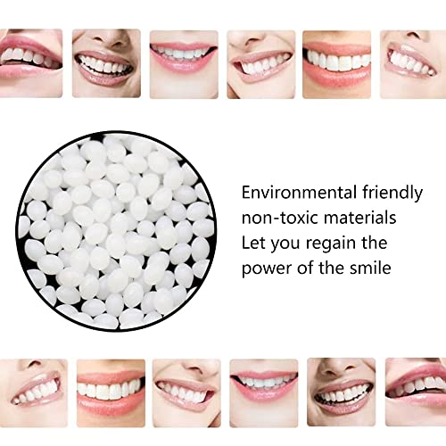 Alinsam 200G Denture Solid Glue Dental Restoration Temporary Tooth Repair Kit #TOP3