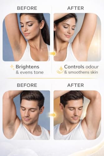 Image of KALYRA Underarm Brightening Roll-On Deodorant - 5% PAD (Potassium Azeloyl Diglycinate) - Controls Body Odour | Smooth & Even-Toned Underarms - For Men & Women(50 Ml) (Pack of 1)