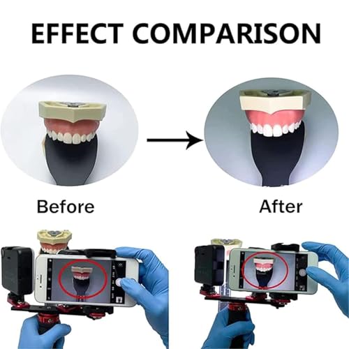 Luz de fotografía dental, luz LED profesional de relleno para cámara oral, video fotográfico en odontología