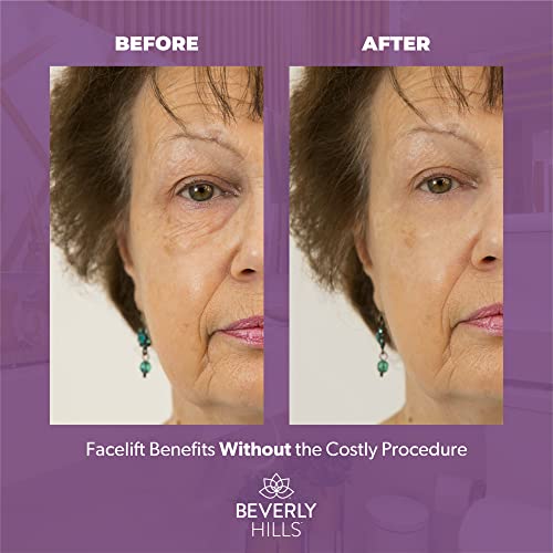 Beverly Hills Instant Facelift and Eye Tuck Serum - For Dark Circles & Puffiness