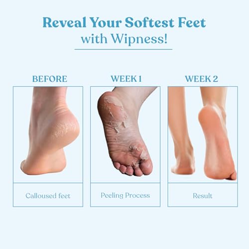 Image of Wipness 100% Natural Foot Peeling & Exfoliating Foot Mask for Baby Soft Feet | Removes Dead Skin & Calluses | Hydrates & Smooths Cracked Heels | Pack of 1 (2 Masks)