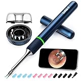 Ear Wax Removal Tool Camera, Ear Wax Removal, Bebird Ear Cleaner