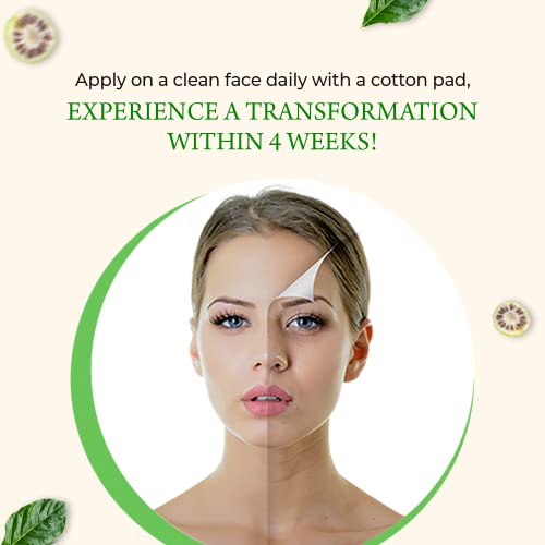 Voilave Noni Serum, Real Noni Energy Ampoule - With 71.77% Noni Fruit Extract & Noni Seed Oil, Serum With Hyaluronic Acid Complex For Face, Reducing Fine Wrinkles, As Seen On Tv #TOP4