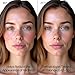 BodyJ4You Hypochlorous Acid Spray for Face Cleaner - HOCL Facial Toner Acne Sensitive Skin - HOCL Molecule Spray Topical Skin Redness Relief Breakouts - Piercing Aftercare Solution Fine Mist - 4 Fl Oz