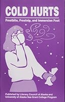 Cold hurts: Frostbite, frostnip, and immersion foot (Outdoor survival series for new readers) 1566120357 Book Cover