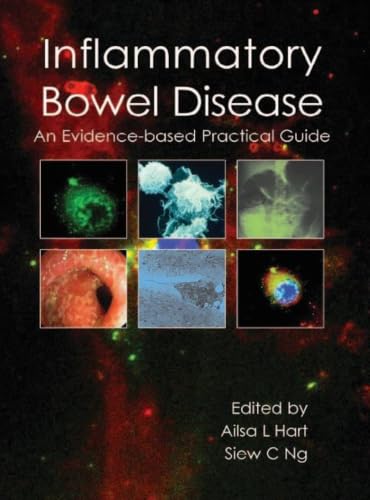 Inflammatory Bowel Disease: an Evidence-based Practical Guide
