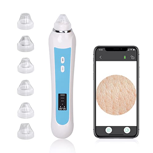 19 Best How To Use Pore Vacuum We Did Not Know We Needed Founder360 Mag