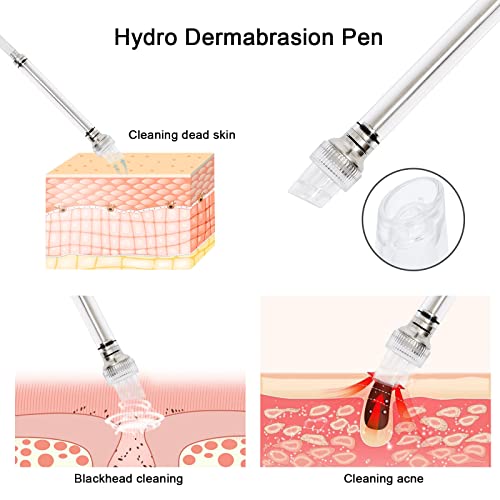 Aimengxi 3 In 1 Diamond Microdermabrasion Machine Professional Beauty Facial Skin Care Equipment Microdermabrasion Device With Vacuum Spray For Salon Personal Home Use(Strong Suction Power: 65-68Cmhg) #TOP4