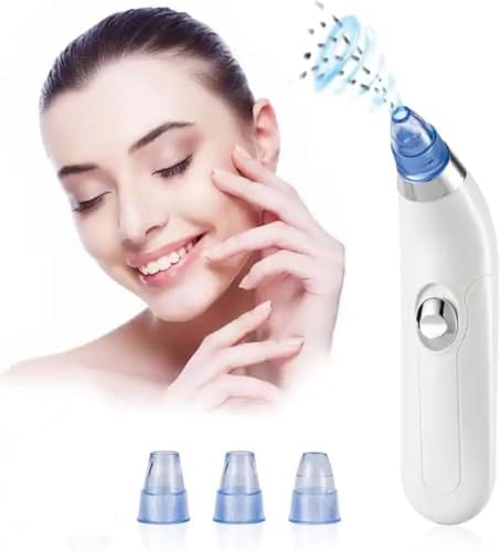 Image of Derma Suction Pore Cleaner - Blackhead Remover Vacuum Device with Suction Heads - Electric Facial Skin Cleanser for Acne, Oil & Dead Skin Removal - Gentle for All Skin Types (White 4 D Suction)