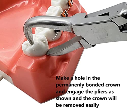 Dental Crown Remover Pliers Debonding Crown Permanent Crown Removing Tool By Artman Instruments #TOP2