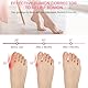 ACWOO Hallux Valgus Korrektur Schiene, 2 Korrektur Schiene und 2x Zehenspreizer, Rutschfester Bunion Zehenspreizer, Korrektur Bandage Socken Bunion Corrector für Damen und Herren（Rosa）