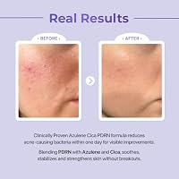 Le' Nubele Azulene Cica Allantoin PDRN Intensive Hyaluronic Gel Cream for Sensitive Skin | PDRN + Squalane + Allantoin + Panthenol | Firming, Lightweight Moisturizer, Korean Skincare | 30ml•1.01fl.oz — image 7