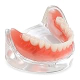 ANNWAH Dental Overdenture Inferior Model - Locator Denture Model with 4 Implants Implant Locator Mod