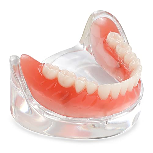 Dental mplant Model Patent Student Demo Educaton Overdenture lower Jaw | eBay