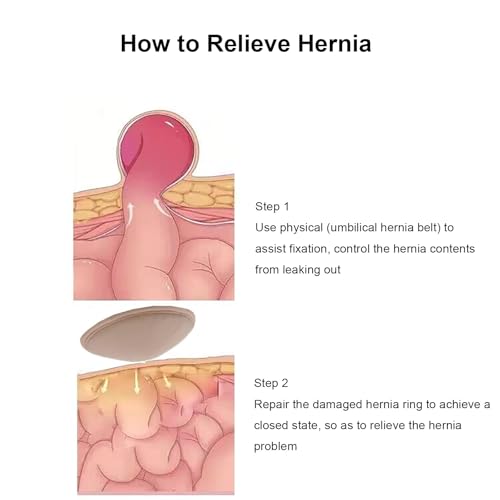 Cinturón para Hernia Umbilical con Soporte y Almohadilla Mediano miniatura 6