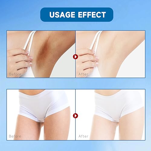 Nirraleza Skin Bleaching Cream For Body Intimate Areas thumb #3