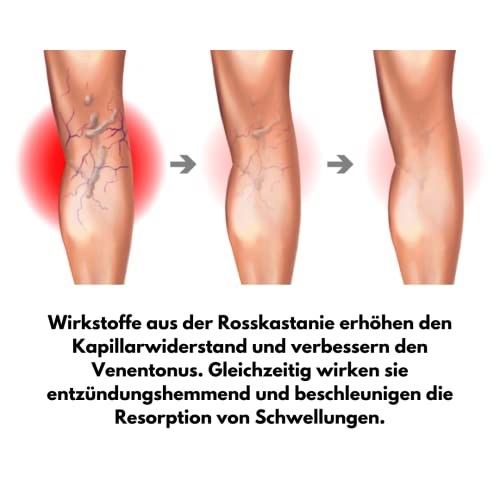 green idea - Rosskastanienmassagegel gegen Krampfadern - Rosskastaniengel und Arnika - Bei Krampfadern und Hämeroiden… - Image 6