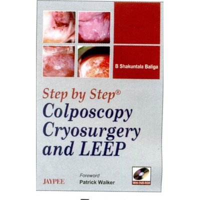 Step By Step Colposcopy Cryosurgery And Leep With Dvd-Rom
