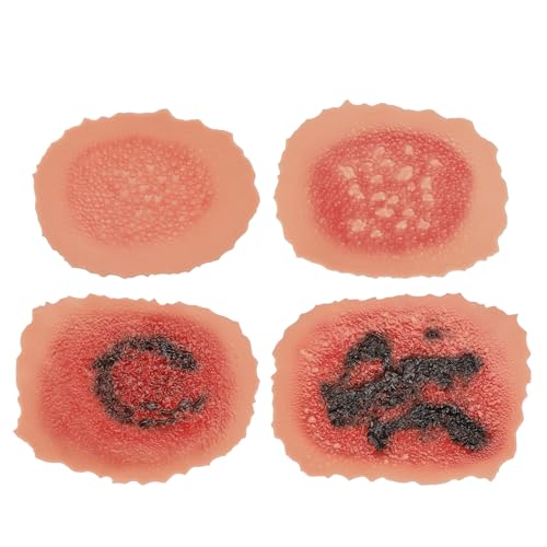 Image of Burn Wound Packing Trainer, Burn Moulages Kit, Adhesive Skin Burn Wound Trainer for Wound Care Training, Burn Wound Training Model
