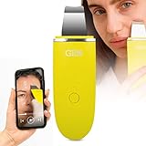 GESS Exotic es un dispositivo profesional para el cuidado de la piel con 7 modos. Está diseñado para el cuidado profesional complejo de la cara. El dispositivo limpiará y estrechará los poros, tensará las líneas finas y los contornos faciales. ¡Verá cómo mejora su piel después de algunos procedimientos!