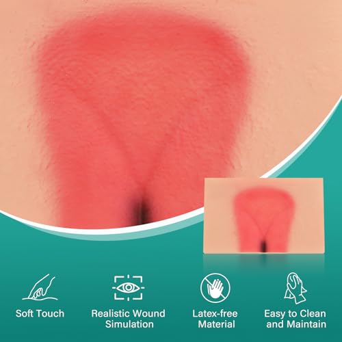 Image of Decubitus Ulcer Wound Care Model, Bedsores Model