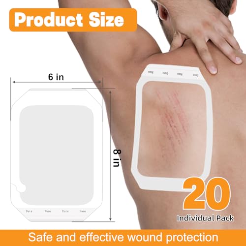 Image of Carbou Transparent Film Dressing, 6 inch x 8 inch, Pack of 20