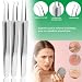 Imagen de 8PCS Herramientas para Eliminar Puntos Negros Extractor Kit