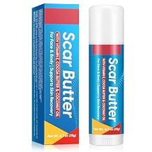 Scar Butter Stick, Scar Cream with Vitamin E & Cocoa Butter for Scars, Fade Scars, Deeply Moisturize, Light & Non-greasy, Scar Repair Stick for Old and Recent Scars and Stretch Marks | 20g