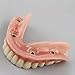 Smile1000 Dental Model Overdenture Inferior 4 Implants Demo for Teaching and Studying