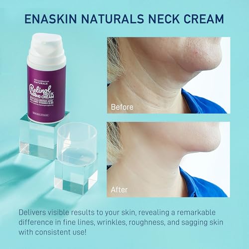 Retinol Neck Firming Cream: Advanced Face Tightening and Lifting Cream with Hyaluronic Acid, Collagen and Vitamin C - Tightening Wrinkles, Firming Sagging Skin on Face, Neck, Décolleté - 2.7 Oz