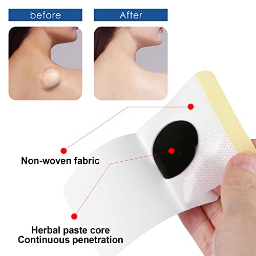 Dhcprj Cerotti Per La Rimozione Del Lipoma, Patch Di Rimozione Dei Grumi Di Lipoma A Base Di Erbe Naturali Veloci Ed Efficaci Per Sbarazzarsi Dei Grumi Grassi Di Lipoma, Cerotti Per La Rimozione Del - 7