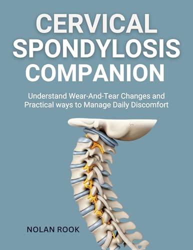 CERVICAL SPONDYLOSIS COMPANION : Understand wear-and-tear changes and practical ways to manage daily discomfort