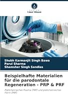 Beispielhafte Materialien für die parodontale Regeneration - PRP & PRF 6205265532 Book Cover