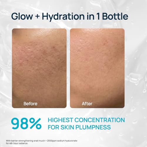 Image of SkinKraft Advanced 98% Snail Mucin Hydrating Serum | All Skin Types | 50ml | Korean instpired glass-skin serum | Sodium hyaluronate & betaine | Hydrates, plumps & smoothens skin
