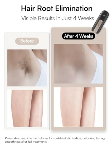 INIA-Laser-Hair-Removal-Device-for-Women-and-Men-INIA-Fond-Hair-Remover-with-Long-Lasting-in-Hair-Reduction-for-BodyFace-Safe-at-home-Results-for-Armpits-Bikini-and-Legs