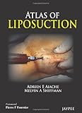  Atlas of Liposuction