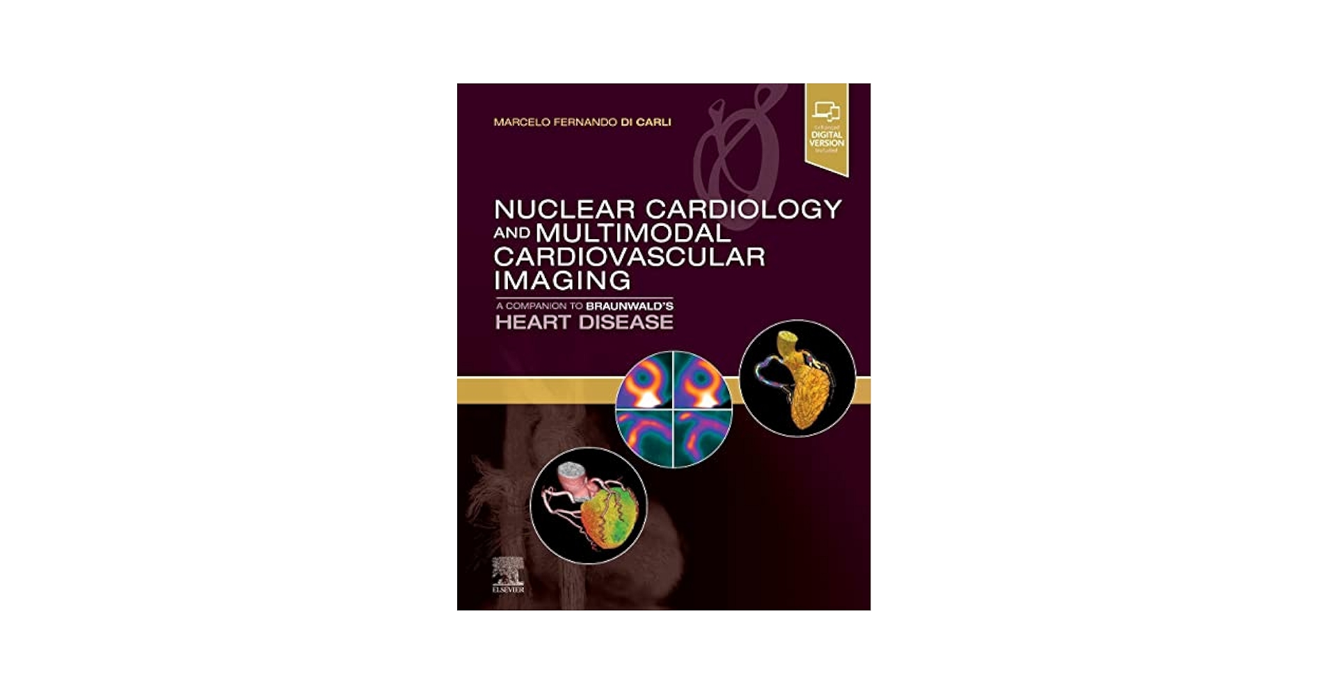洋書 Atlas of Nuclear Cardiology 2nd edition Atlas of Nuclear Cardiology: Dilsizian, Vasken, Narula