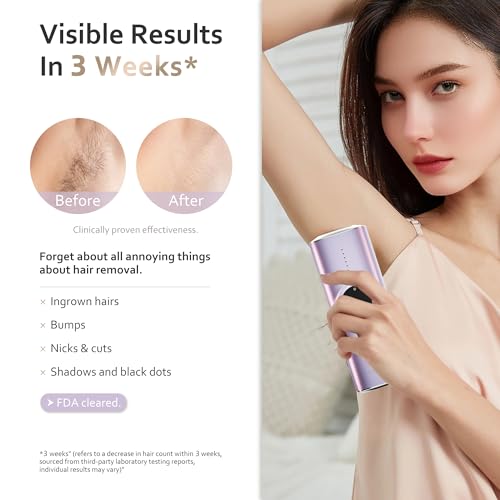 Image of BeautyGlow Laser Hair Removal Device for Women, At Home IPL Hair Remover with Ice Cooling Technology for Face and Body, Painless & Long-Lasting Results