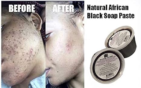 100% Natural African Black Soap Paste 16 oz