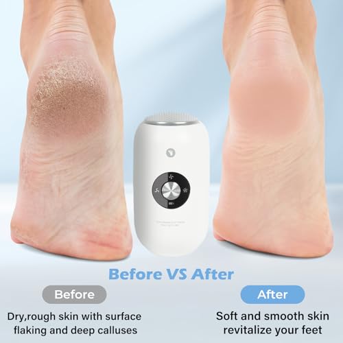 Electric Foot Callus Remover Grinder - Rechargeable Pedicure Tools Callus Remover for Feet Foot Scrubber File Foot Care with 3 Speeds 2 Stainless Grinding Heads for Hard Cracked Dry Dead Skin — view 6