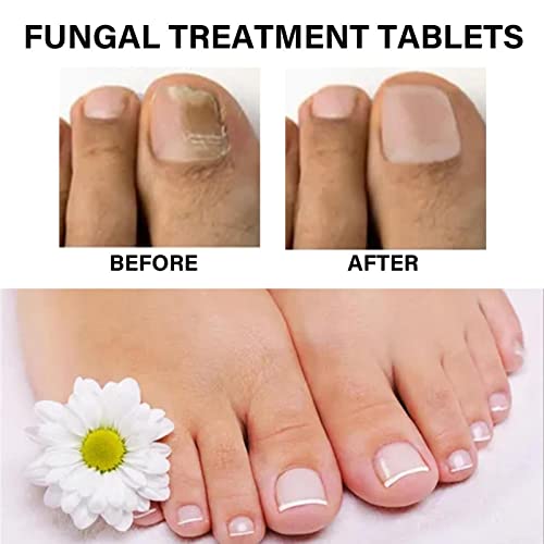Ginger Foot Soak | Leg Slimming Foot Bath - Ginger Foot Soak Tablets, Sweat Body Sculpting Foot Bath