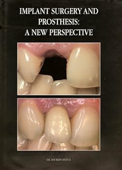 Hardcover Implant Surgery and Prosthesis: A New Perspective Book