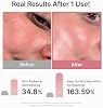 Mascarilla de hoja Medicube Salmon DNA PDRN Pink Vitamin Coated, 10 unidades | Mascarilla facial para hidratación, firmeza y equilibrio de la piel - Cuidado lujoso en casa, cuidado coreano, 0.77 oz, 10 unidades 5