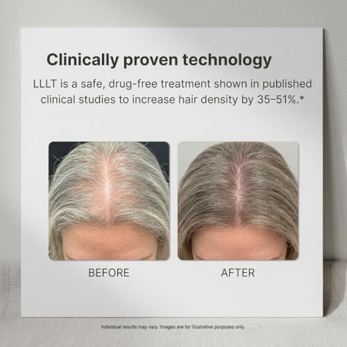 Image of Turbo Pro Laser Hair Growth Cap with 316 Lasers - 6 Minute Treatment Time for Thinning Hair | Hair Loss Treatment | Hair Regrowth Cap for Men and Women