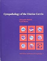 Cytopathology of the Uterine Cervix (Ascp Theory and Practice of Cytopathology, Vol 1) 0891892990 Book Cover